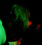 Annotation of an Autopsy, 16 septembre 2011, Igelrock (Valenciennes)