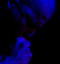 Lost Opera, Igelrock (Valenciennes), 25 novembre 2011